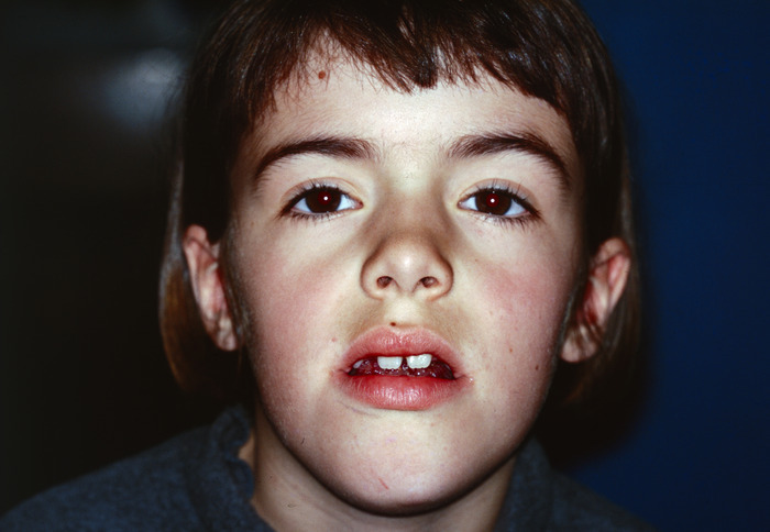 Lymph Blood Story 9424